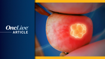 Intermediate-Risk Prostate Cancer|  © vitanovski - stock.adobe.com