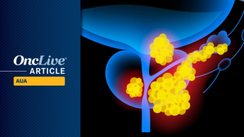 MIBC | Image Credit: © pikovit - stock.adobe.com