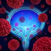 Epithelial Tumors