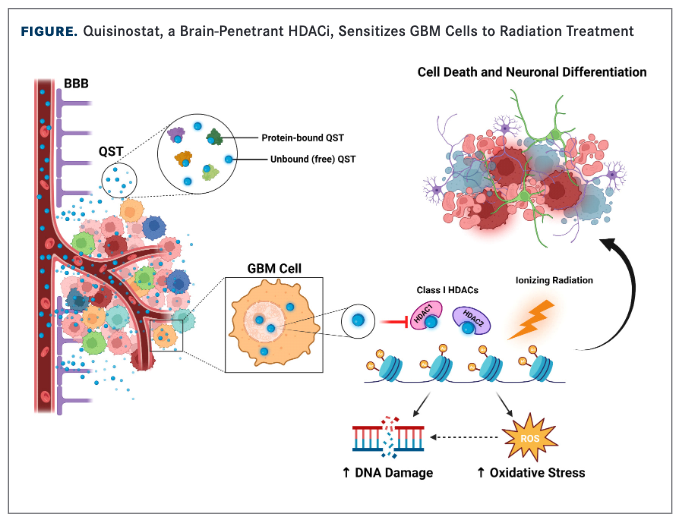 Figure. Quisinostat, a Brain-Penetrant HDACi, Sensitizes GBM Cells to Radiation Treatment