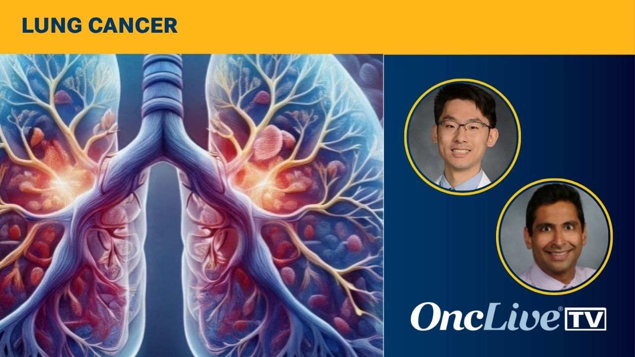 Lung cancer | Image by Ashling Wahner & MJH Life Sciences Using AI