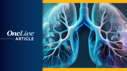 Targeted Therapies Move the Needle in NSCLC