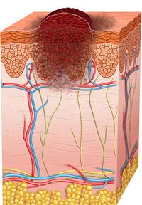 figure image