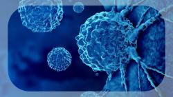 AI Tool Set to Transform Characterization and Treatment of Cancers