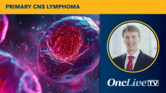 Primary CNS Lymphoma | Image Credit: © LELISAT - stock.adobe.com