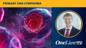 Primary CNS Lymphoma | Image Credit: © LELISAT - stock.adobe.com