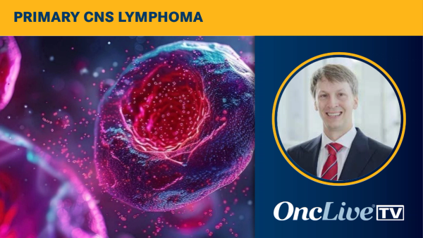 Primary CNS Lymphoma | Image Credit: © LELISAT - stock.adobe.com