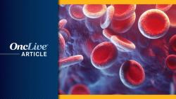 Retrospective Study Shows BTK Inhibitors Provide PFS Advantage in NOTCH1-Mutated CLL