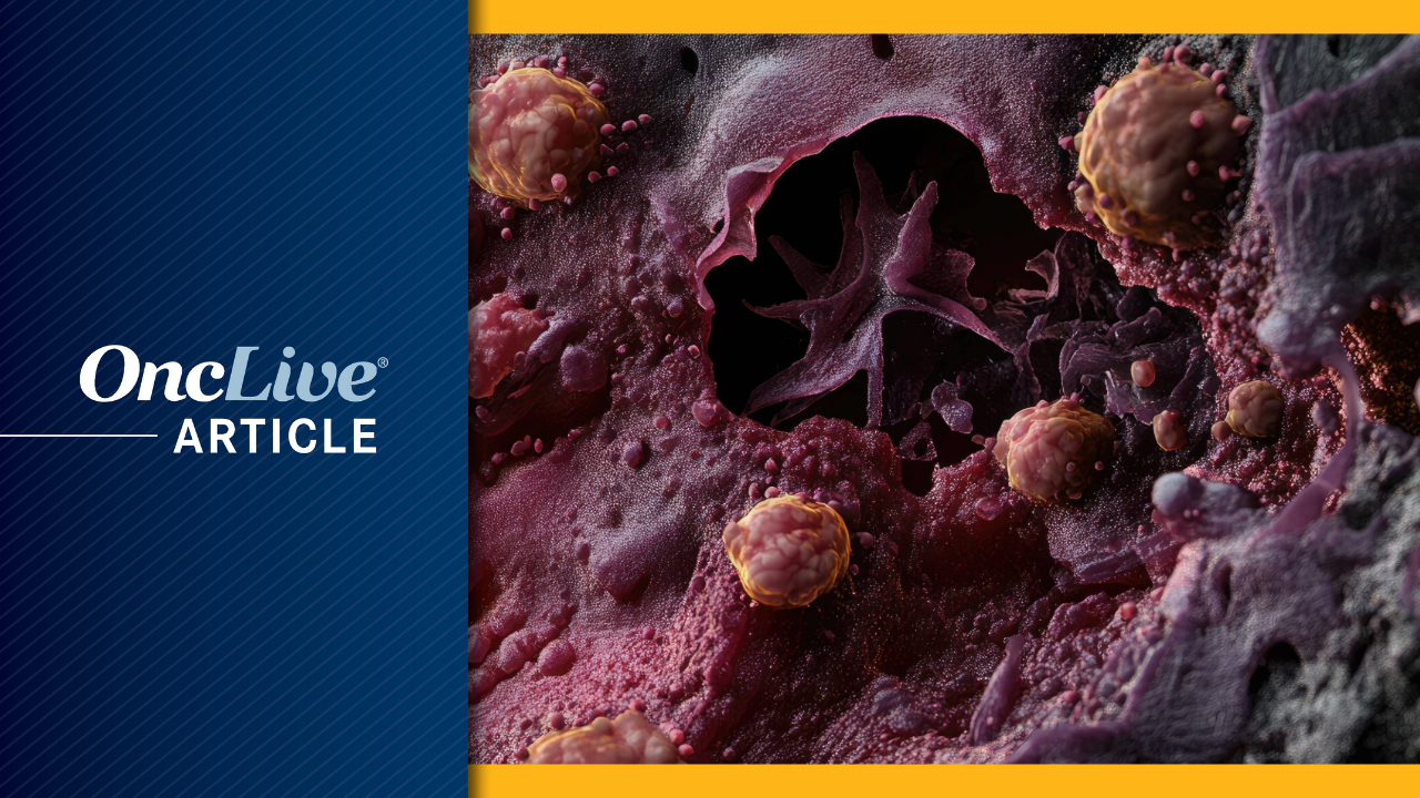 Advanced Melanoma | Image Credit: © Artur - stock.adobe.com