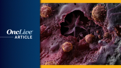 Updated Cosibelimab Label Reflects Long-Term Data in Advanced CSCC