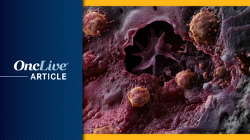 Advanced Melanoma | Image Credit: © Artur - stock.adobe.com