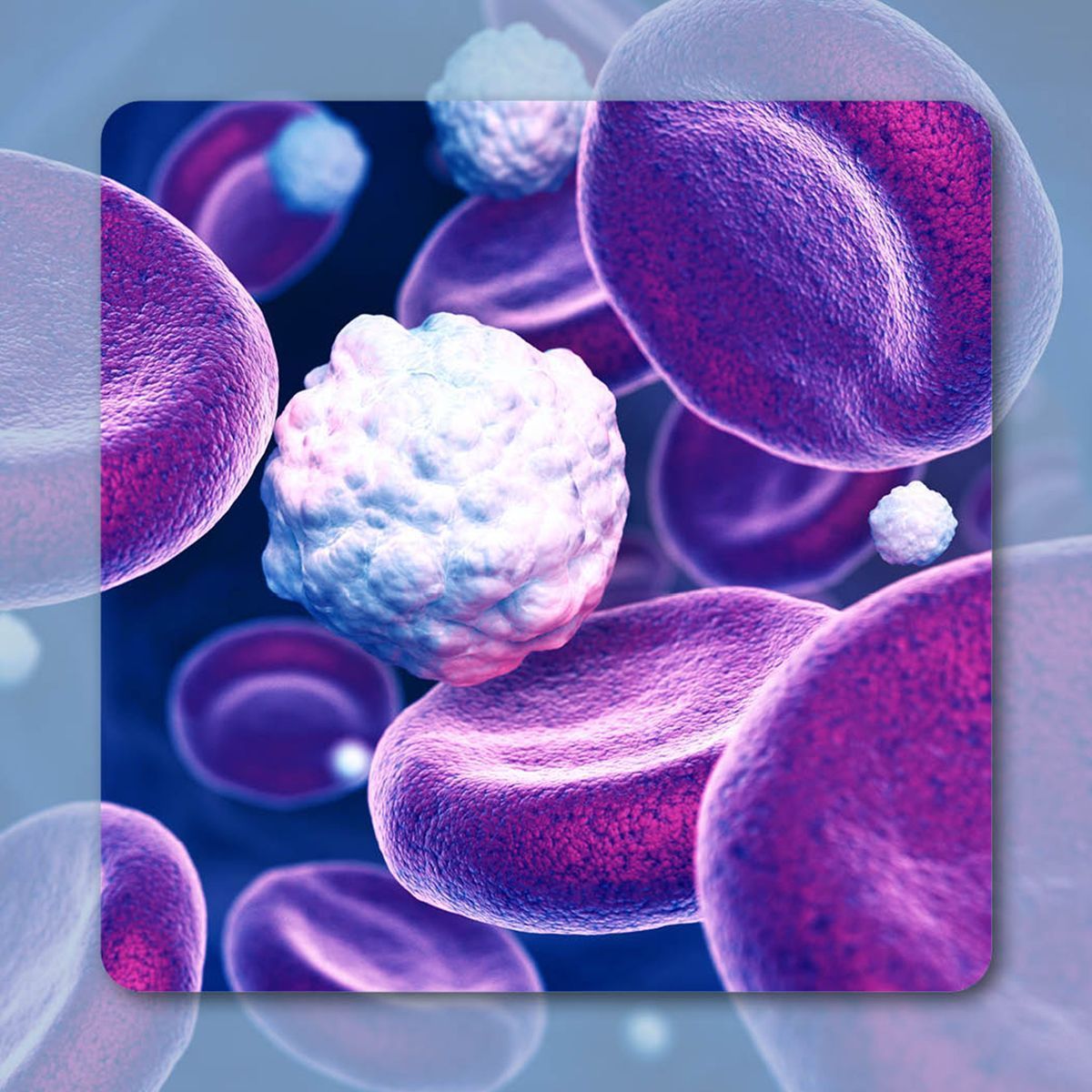 Mantle cell lymphoma | Image Credit: © Tatiana Shepeleva – stock.adobe.com