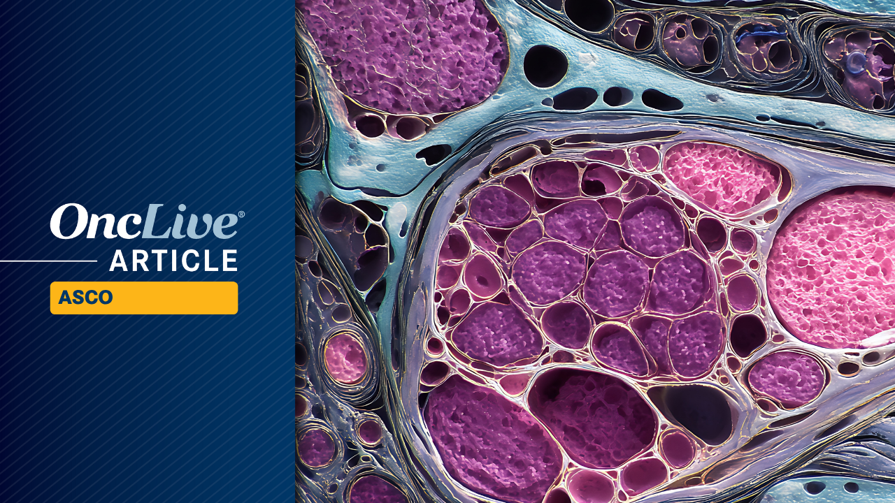 Abemaciclib Produces First Positive Phase 3 Trial Result in Dedifferentiated Liposarcoma