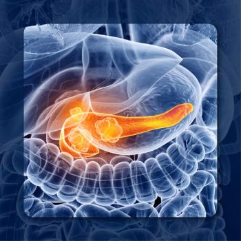 FOLFIRINOX in Metastatic PDAC | Image Credit: © Sebastian Kaulitzki – stock.adobe.com