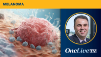 Intismeran Plus Pembrolizumab in Resected Melanoma | Image Credit: © Maris - stock.adobe.com