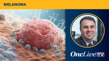 Intismeran Plus Pembrolizumab in Resected Melanoma | Image Credit: © Maris - stock.adobe.com