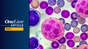 T/NK Cell Lymphoma | Image Credit: © Curie - stock.adobe.com