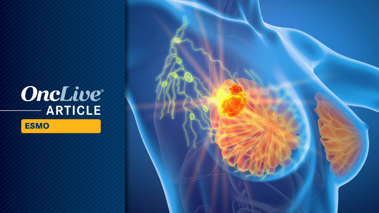 Sac-TMT in HR+, HER2– breast cancer : © vitanovski - stock.adobe.com