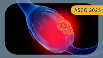 Epithelial Ovarian Cancer | Image credit:   © Sebastian Kaulitzki - stock.adobe.com