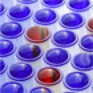 Beyond PSA: A Summary Review of Predictive/Prognostic Biomarkers in Prostate Cancer