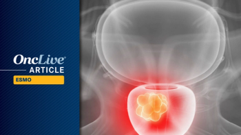 Lutetium Lu 177 Vipivotide Tetraxetan in PSMA+ mHSPC  |  Image Credit: © Sebastian Kaulitzki - stock.adobe.com
