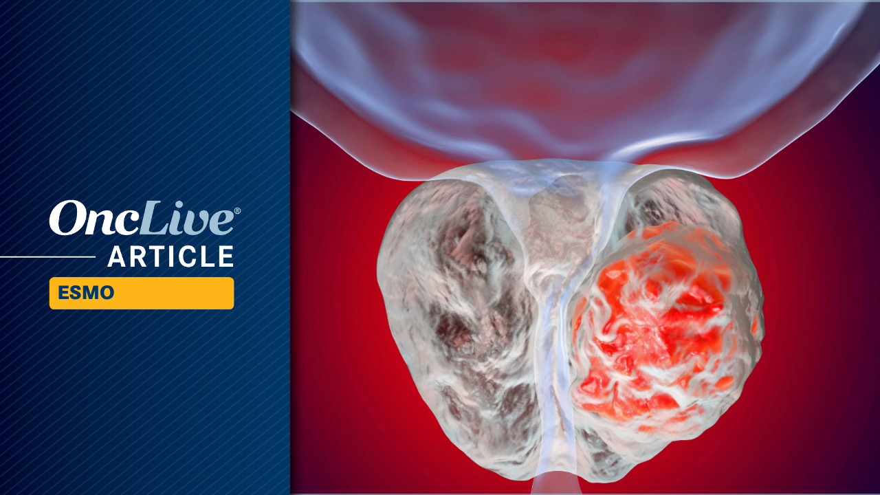 Saruparib plus an ARPI in metastatic prostate cancer:  © Dr_Microbe- stock.adobe.com