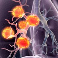 Acquired resistance because of genetic alterations in the MET receptor has limited the efficacy of the EGFR inhibitor osimertinib in patients with non–small cell lung cancer. Investigators have sought to circumvent this barrier through targeting MET protein activity with the addition of the novel MET TKI, savolitinib.