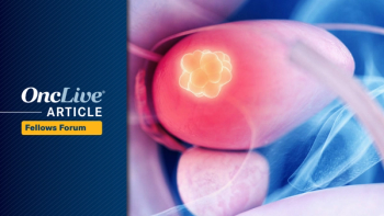 Muscle-Invasive Bladder Cancer | Image Credit: © Sebastian Kaulitzki - stock.adobe.com