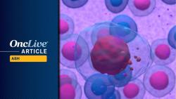 Dual BCMA/CD19 CAR T-cell Therapy AZD0120 Shows Promise for Multiple Myeloma