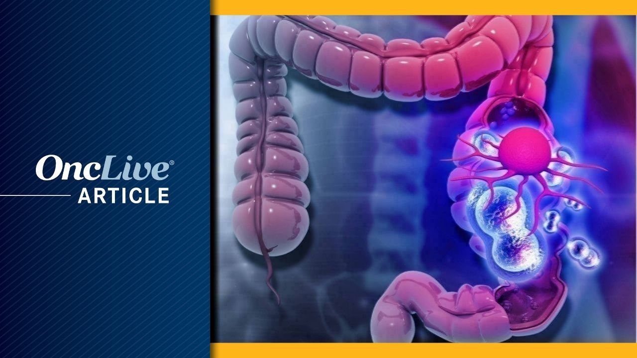 Tucatinib Plus Trastuzumab in HER2+ mCRC:   ©Rasi - stock.adobe.com