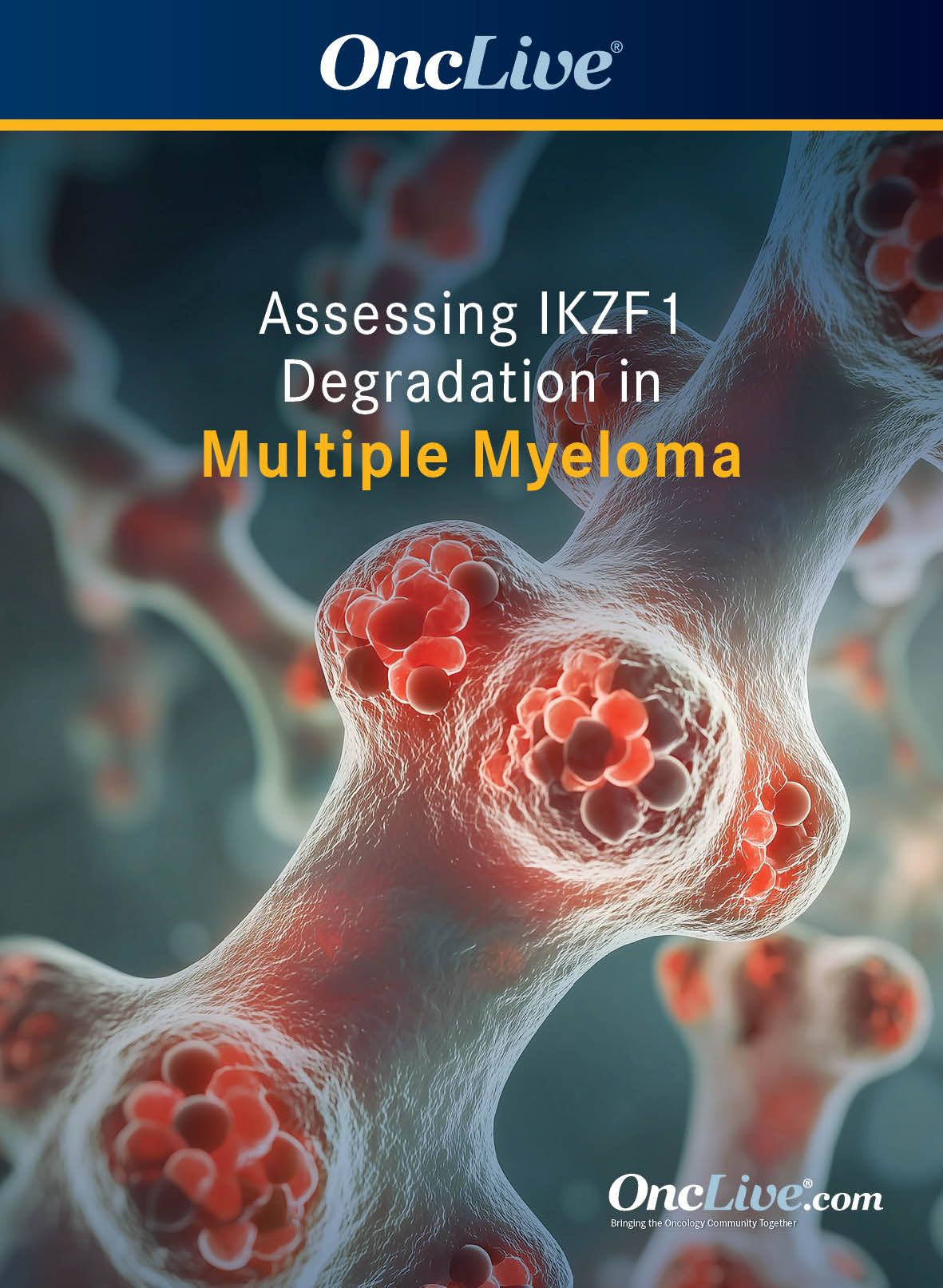 Assessing IKZF1 Degradation in Multiple Myeloma