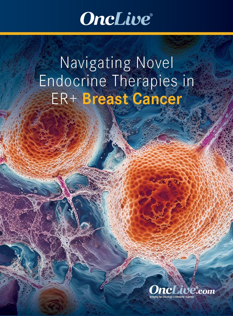 Ongoing Research Aims to Alter Management of HR+ Breast Cancer After ...
