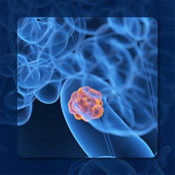 Colorectal Cancer |  Image Credit: © Sebastian Kaulitzki  – stock.adobe.com