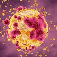 Gastrointestinal stromal tumor