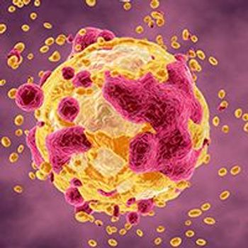 Gastrointestinal stromal tumor