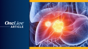 Bile Duct Cancer | Image Credit: © Sebastian Kaulitzki - stock.adobe.com