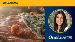 Dr Orloff on OS Outcomes With Darovasertib Plus Crizotinib in Metastatic Uveal Melanoma