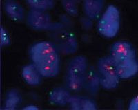 HER2-positive tumor cells