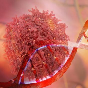 Francesca Aroldi, lead study author, and clinical research fellow at the University of Oxford