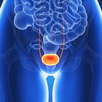 UGN-102 Elicits Durable Responses in Low-Grade Intermediate-Risk Non-Muscle Invasive Bladder Cancer