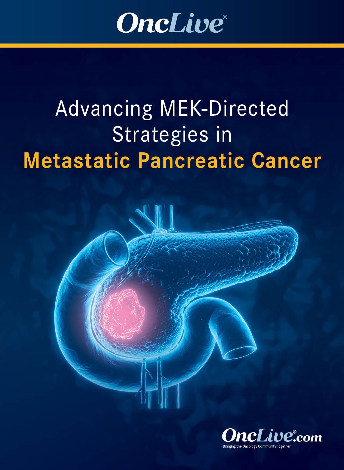 Advancing MEK-Directed Strategies in Metastatic Pancreatic Cancer