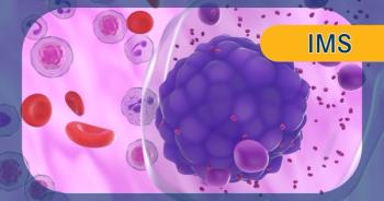 Multiple Myeloma | Image Credit: © LASZLO - stock.adobe.com