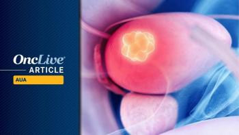 Non–muscle-invasive bladder cancer | Image Credit: © Sebastian Kaulitzki - stock.adobe.com