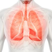 lung cancer