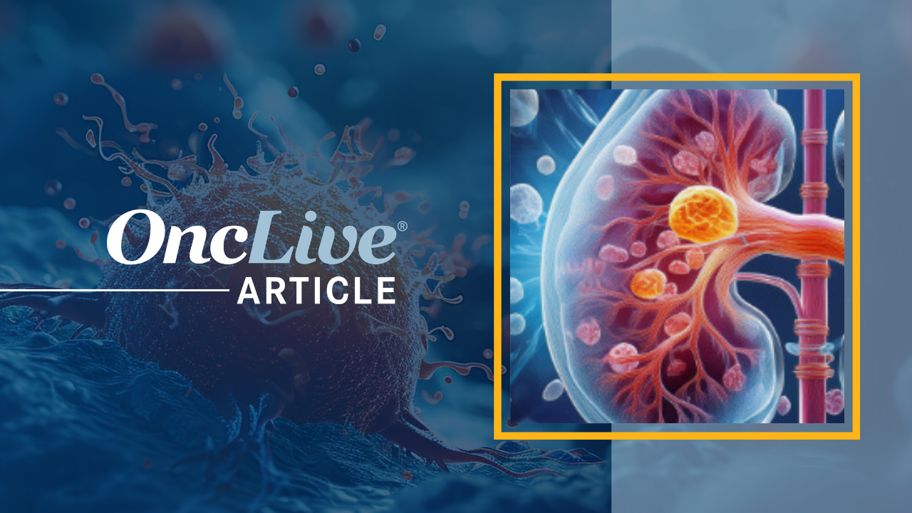 Renal Cell Carcinoma | Image by Ashling Wahner &  MJH Life Sciences Using AI