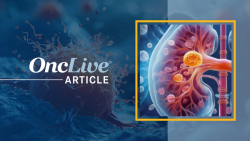 Bevacizumab Plus Erlotinib Shows Antitumor Activity in Advanced Papillary Renal Cell Carcinoma