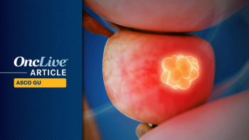 Prostate Cancer | Image Credit: © Sebastian Kaulitzki - stock.adobe.com