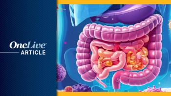 Gastrointestinal cancer | Image Credit: © Image by Ashling Wahner & MJH Life Sciences Using AI