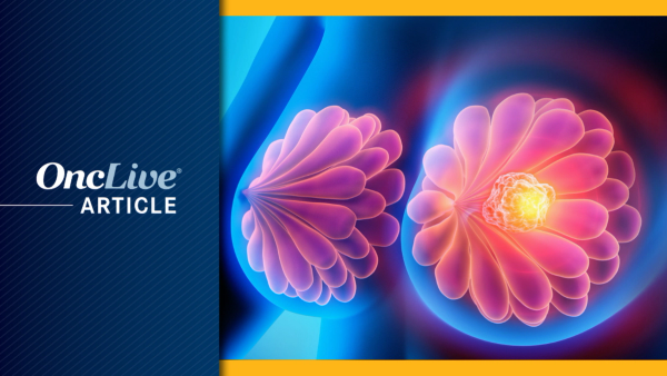 MammaPrint/BluePrint for Determining Anthracycline Benefit in Breast Cancer:   ©peterschreiber.media - stock.adobe.com