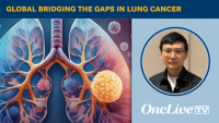 Global Bridging the Gaps in Lung Cancer | Image Credit: © Ashling Wahner & MJH Life Sciences Using AI